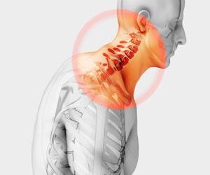 Como evitar problemas cervicales